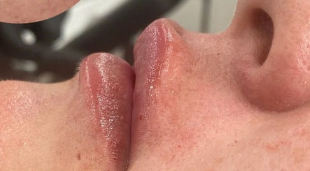 Close-up of glossy, hydrated lips after treatment at hd aesthetics Bearsted, Bearsted, England, GB.