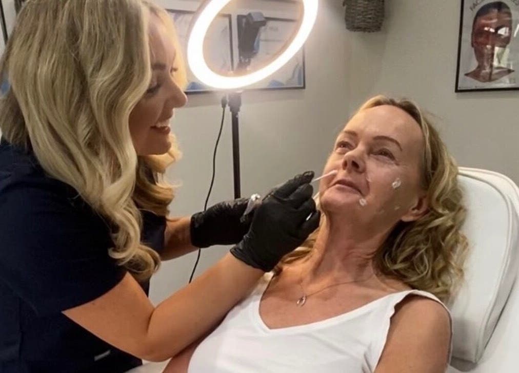 Professional skin treatment at hd aesthetics Rainham Tangels hair and beauty, Gillingham, England, GB.