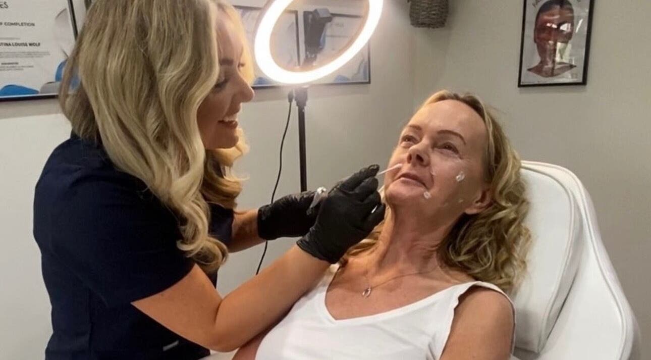 Professional skin treatment at hd aesthetics Rainham Tangels hair and beauty, Gillingham, England, GB.