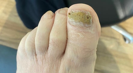 Coventry Foot care and Podiatry image 3