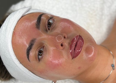 Facial glow treatment at BY ALH, Essex, England, GB. Smooth, radiant skin post-treatment.