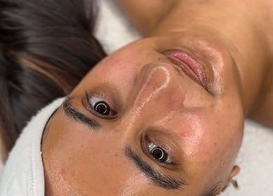 Facial treatment at BY ALH, Essex, England, GB, showcasing a rejuvenated, glowing complexion.