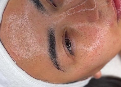 Close-up of glowing skin after facial at BY ALH, Essex, England, GB.