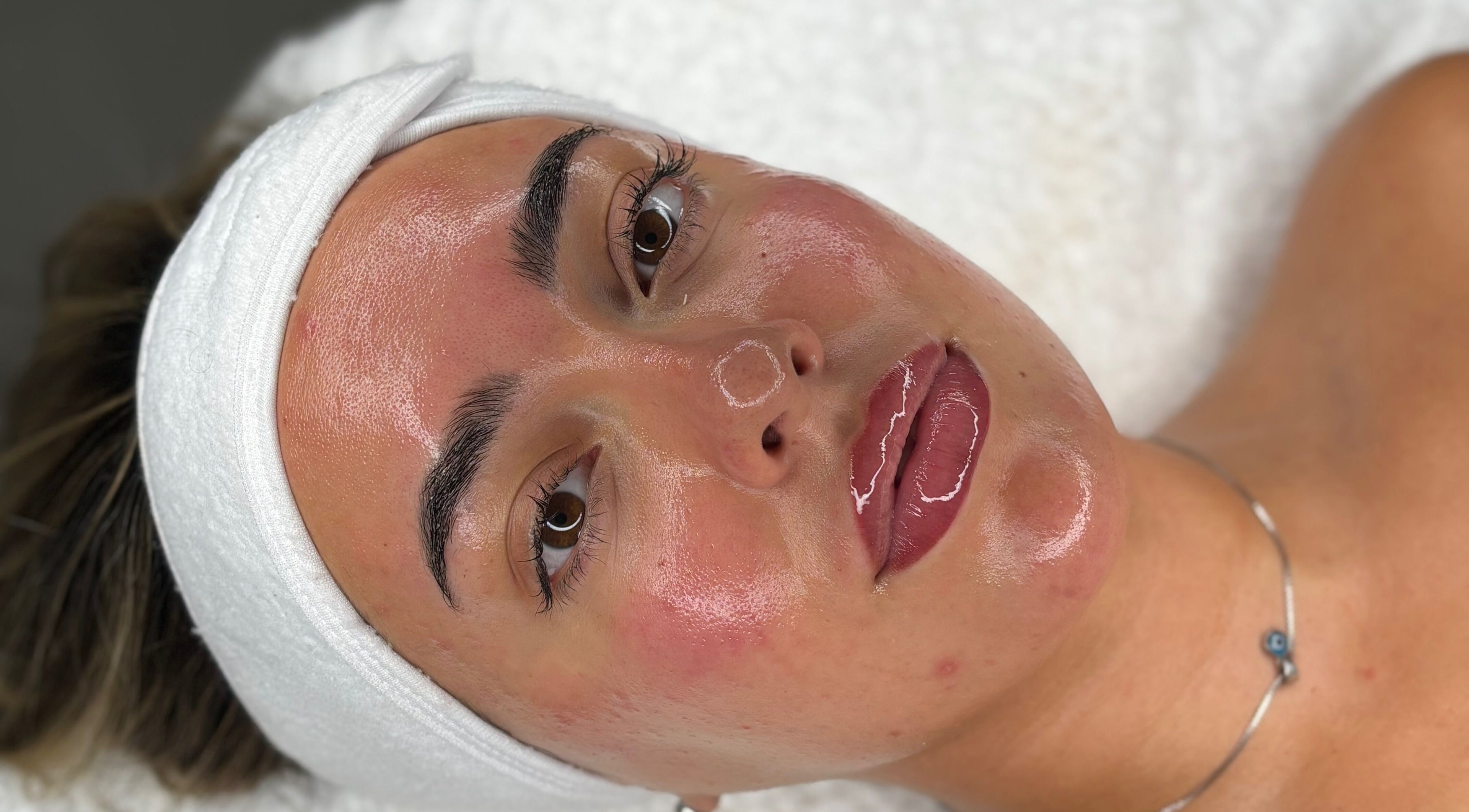Close-up of a client's glowing skin after facial at BY ALH in Essex, England, GB.