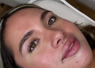Close-up of a client's radiant face after a treatment at London Aesthetic Clinic - Canary Wharf, London, England, GB.