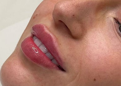 Close-up of enhanced lips at London Aesthetic Clinic - Canary Wharf, London, England, GB.