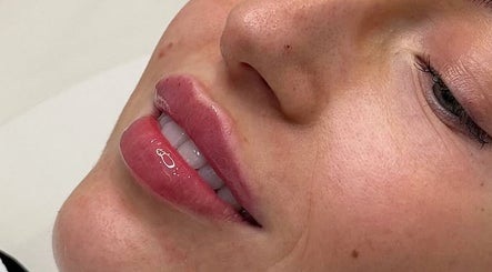 Close-up of enhanced lips at London Aesthetic Clinic - Canary Wharf, London, England, GB.