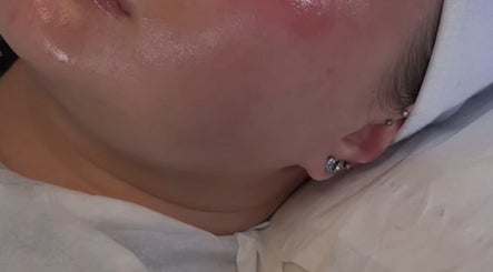 Facial treatment at BY.DW in Clydebank, Scotland, GB showcases a glowing complexion post-treatment.