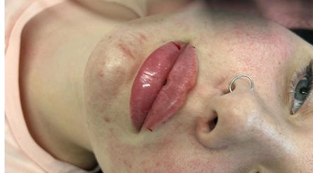 Close-up of polished lips at Boujee B*tch Aesthetics, Southampton, England, GB.