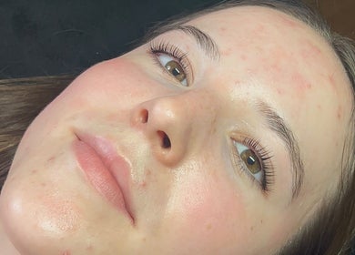 Close-up of a client's rejuvenated face at EM Beauty And Massage, Dereham, England, GB.