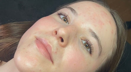 Close-up of a client's rejuvenated face at EM Beauty And Massage, Dereham, England, GB.