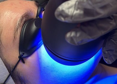 Tratamiento facial con luz azul en Beldad.mx, San Francisco Coacalco, Estado De México, MX.