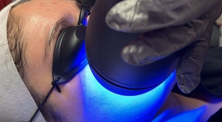 Tratamiento facial con luz azul en Beldad.mx, San Francisco Coacalco, Estado De México, MX.