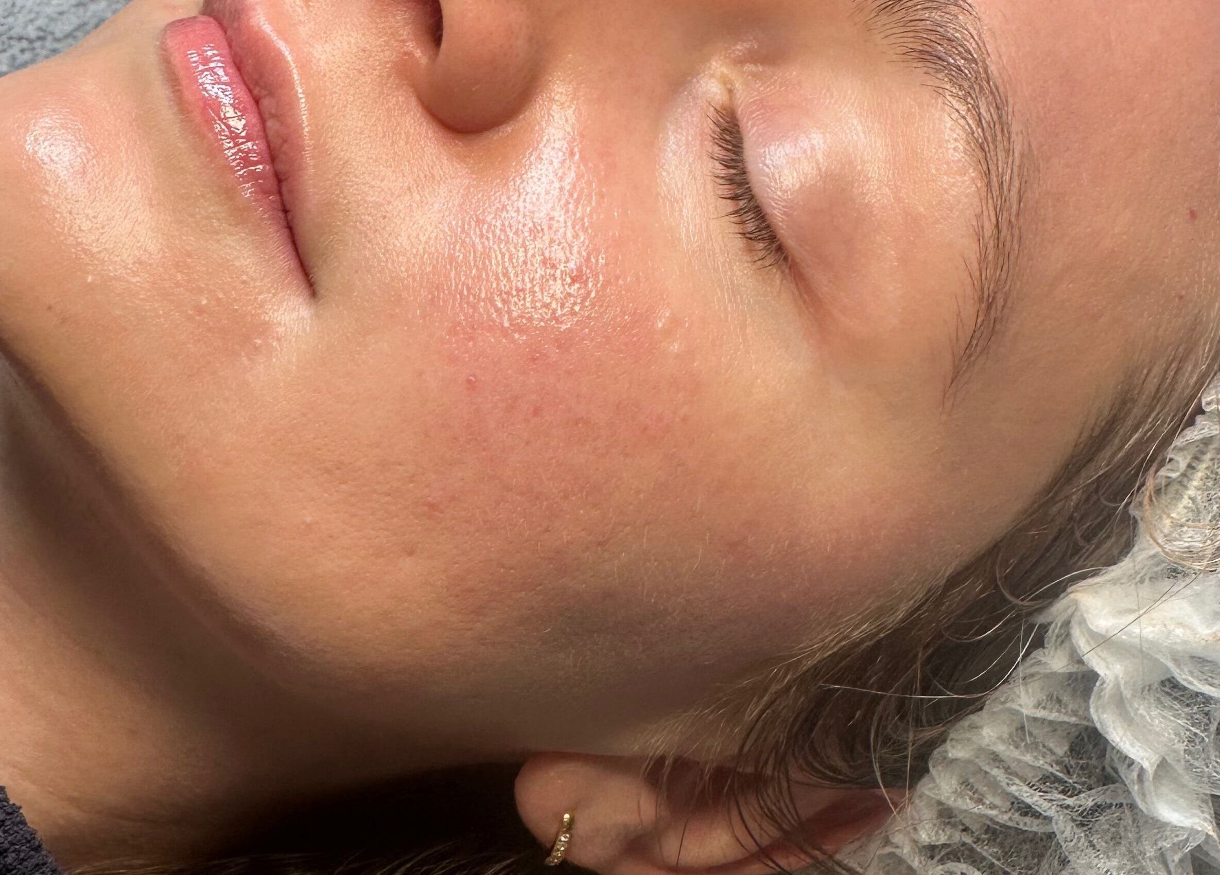 Close-up of a peaceful face after facial treatment at The Renewed Lab, Harrold, England, GB.