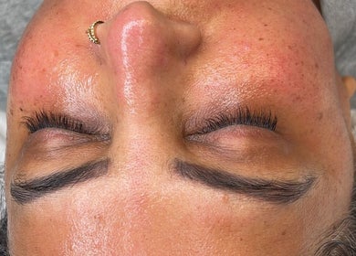 Close-up of glowing skin post-treatment at skinbyparvati_ in Over Hulton, England, GB.