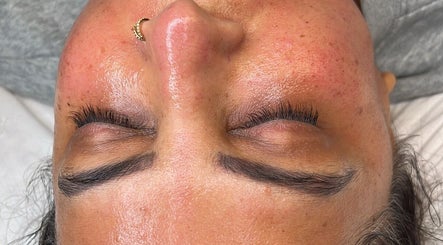 Close-up of glowing skin post-treatment at skinbyparvati_ in Over Hulton, England, GB.