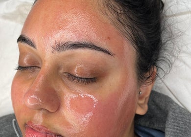 Skin rejuvenation at skinbyparvati_ in Over Hulton, England, GB. Close-up of woman's radiant, freshly treated face.