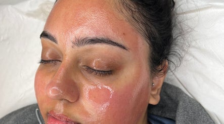 Skin rejuvenation at skinbyparvati_ in Over Hulton, England, GB. Close-up of woman's radiant, freshly treated face.