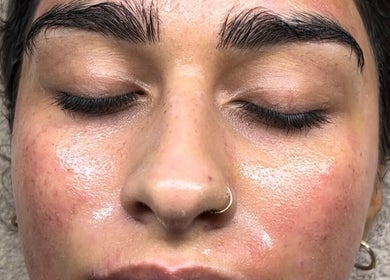 Close-up of glowing skin after treatment at skinbyparvati_ in Over Hulton, England, GB.