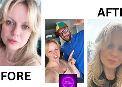 Before and after beauty transformation at Birch Barn Therapies, Castlethorpe, England, GB.