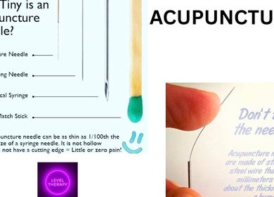 Comparison of acupuncture needle size at Birch Barn Therapies, Castlethorpe, England, GB.