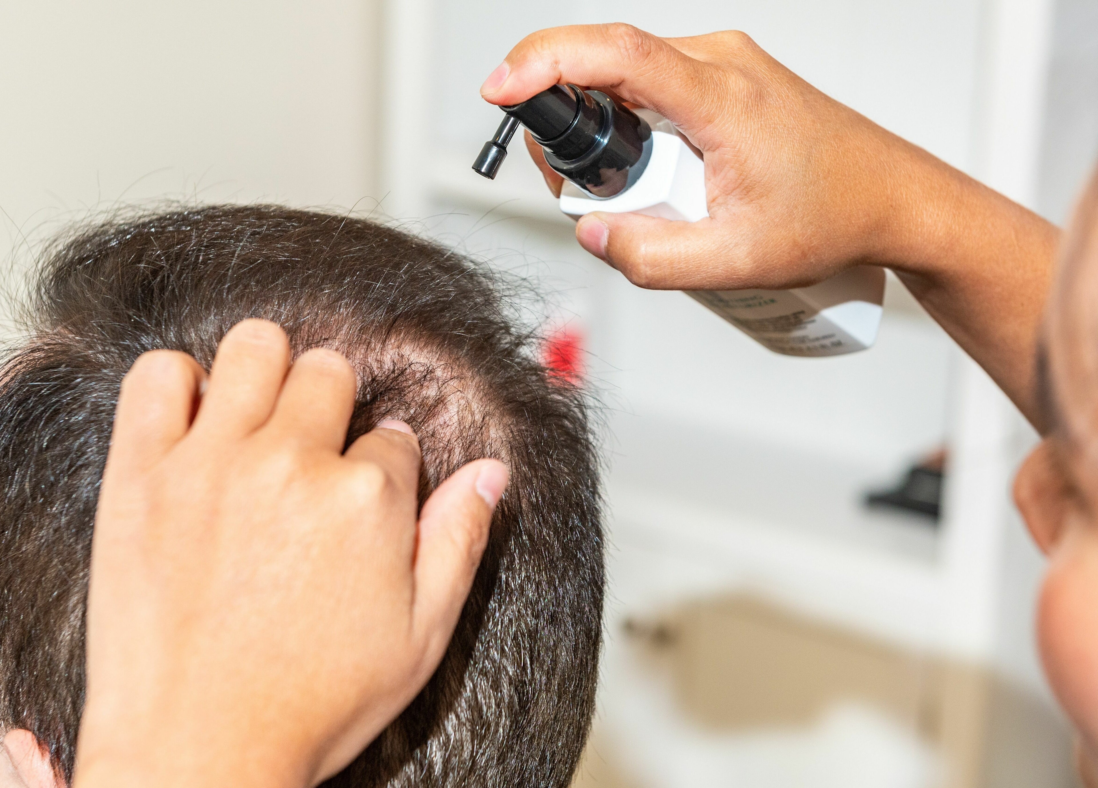 Scalp treatment at Siyu Hair SPA, Henderson, Nevada, US, showcasing expert care.