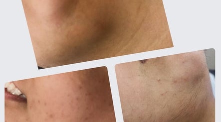 Hình ảnh 2 của serenity aesthetics and laser clinic ltd