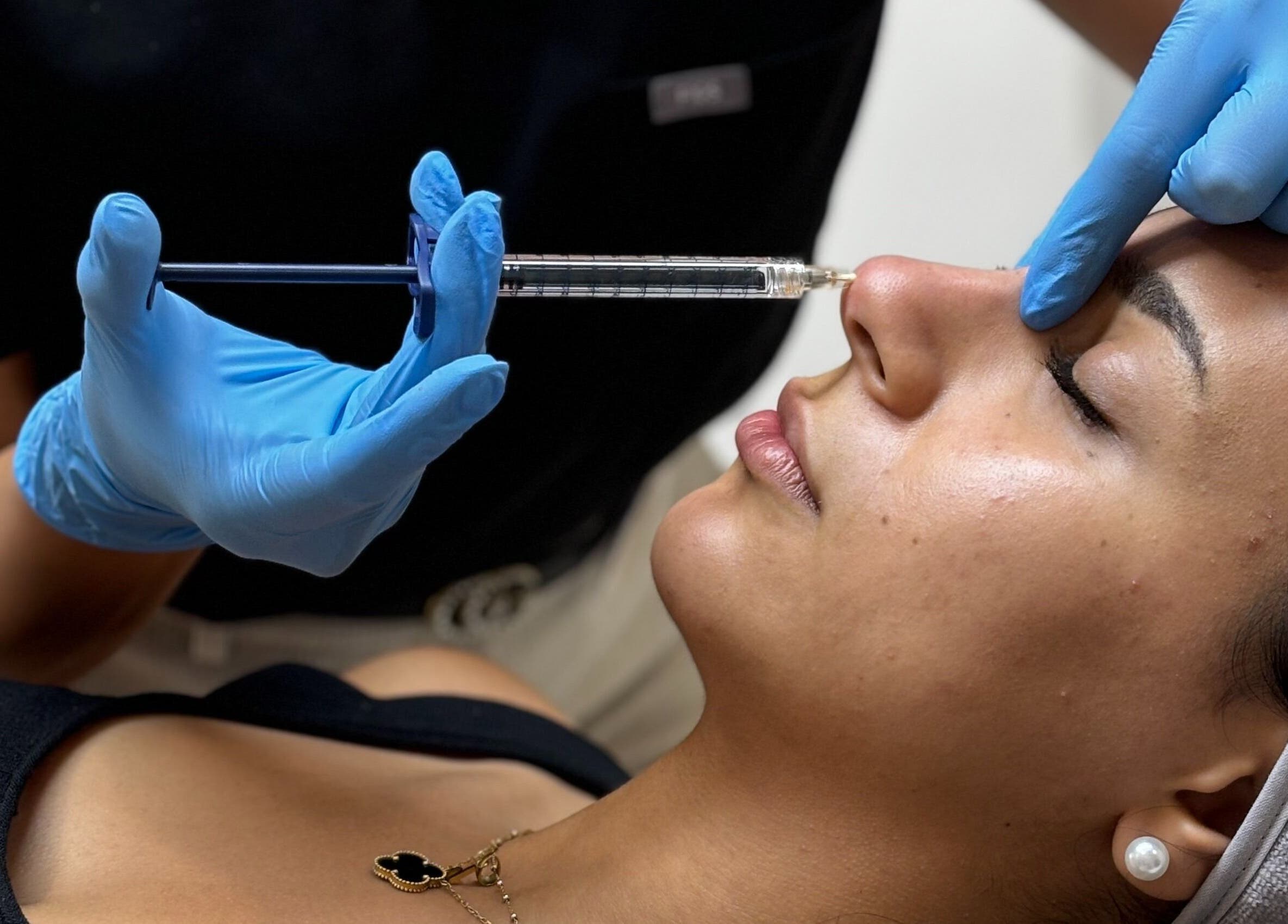 Professional non-surgical nose treatment at DAS Aesthetics, London, England, GB with expert care.