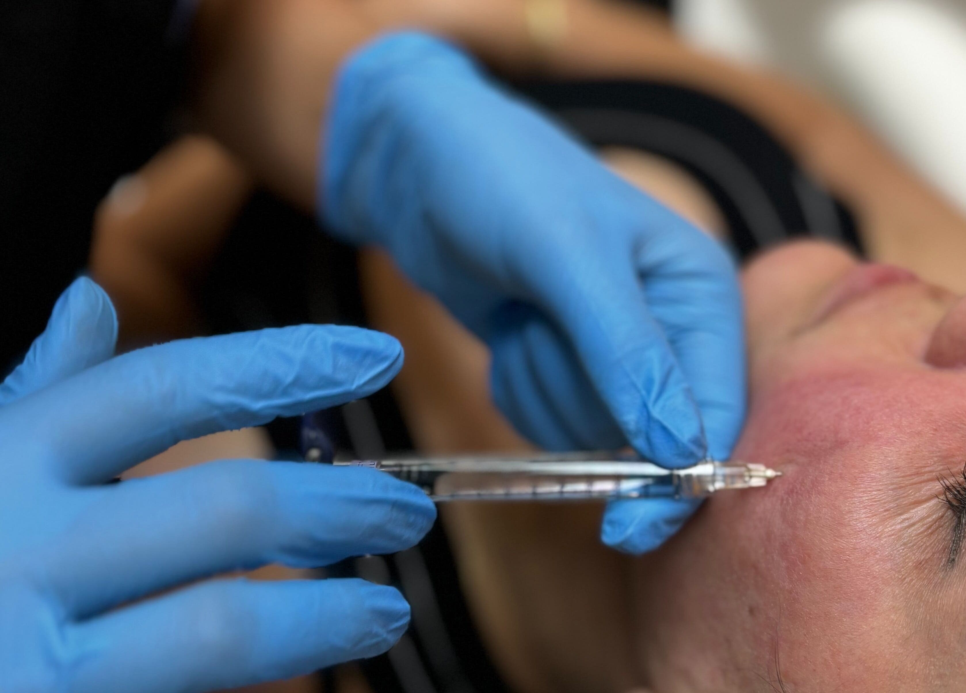 Facial treatment in progress at DAS Aesthetics, London, England, GB, highlighting expert care and precision.