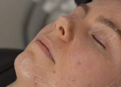 Facial treatment at Regen Skin, Melbourne, Victoria, AU, showcasing serene client experience.