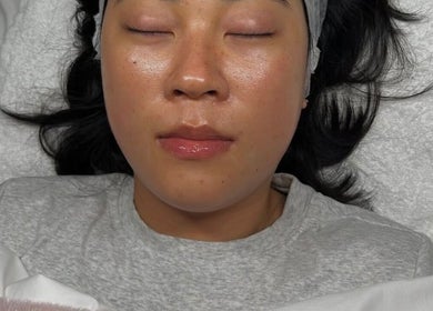 Client with glowing skin after facial at Glow Your Skin by Shona, Chapel Hill, Queensland, AU.