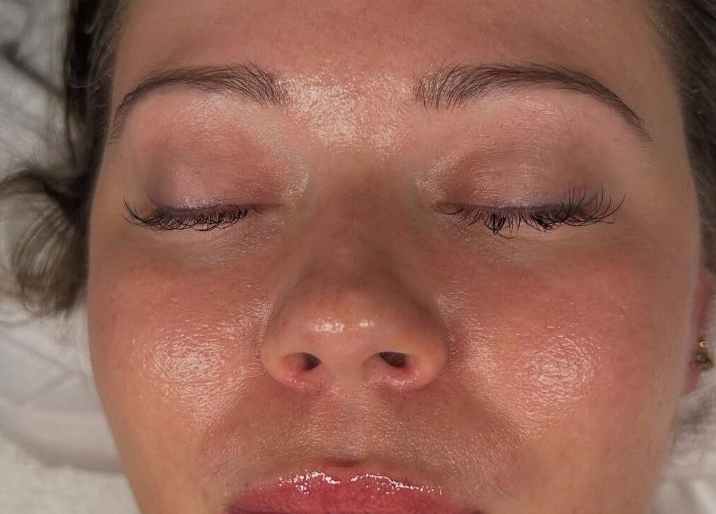 Close-up of a relaxed face with glowing skin at Glow Your Skin by Shona, Chapel Hill, Queensland, AU.