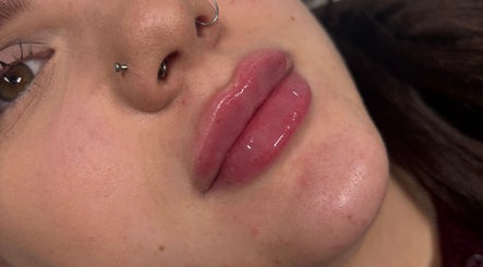 Close-up of glossy, enhanced lips at Mad Aesthetics, Southampton, England, GB, showcasing beauty excellence.