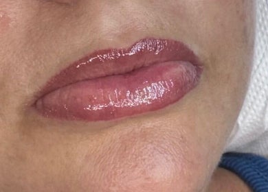 Close-up of glossy lips at Mad Aesthetics, Southampton, England, GB, showcasing a perfect lip enhancement.