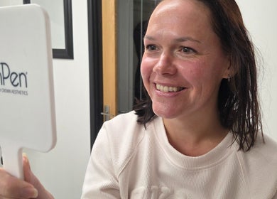 Smiling woman admires reflection using SkinPen at DermaDivine Skin Rejuvenation, Tamworth, England, GB.