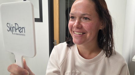 Smiling woman admires reflection using SkinPen at DermaDivine Skin Rejuvenation, Tamworth, England, GB.