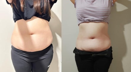 DMS Beauty Body Sculpting image 2