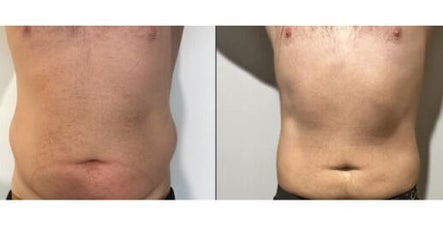 DMS Beauty Body Sculpting image 3