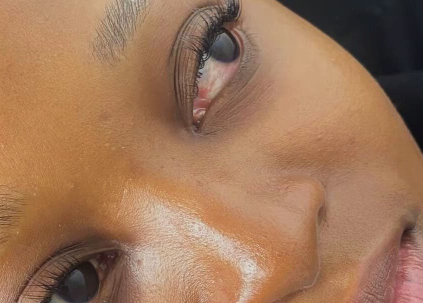 Close-up of smooth, glowing skin after treatment at Aura Beauty, Westville, KwaZulu-Natal, ZA.