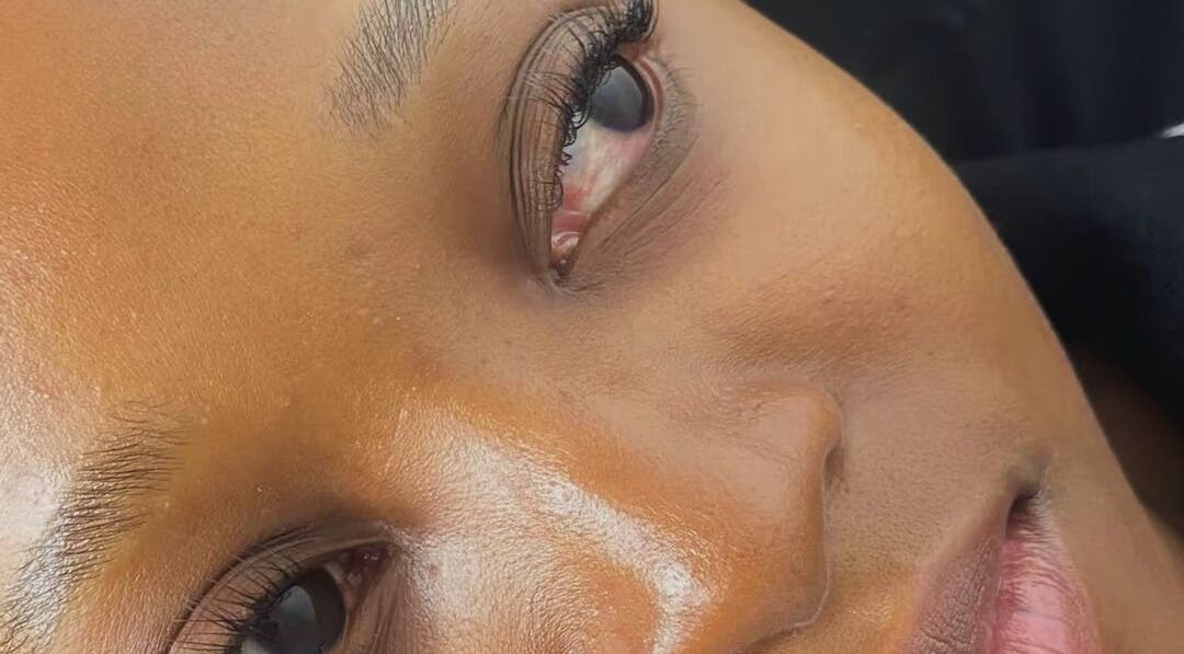 Close-up of smooth, glowing skin after treatment at Aura Beauty, Westville, KwaZulu-Natal, ZA.