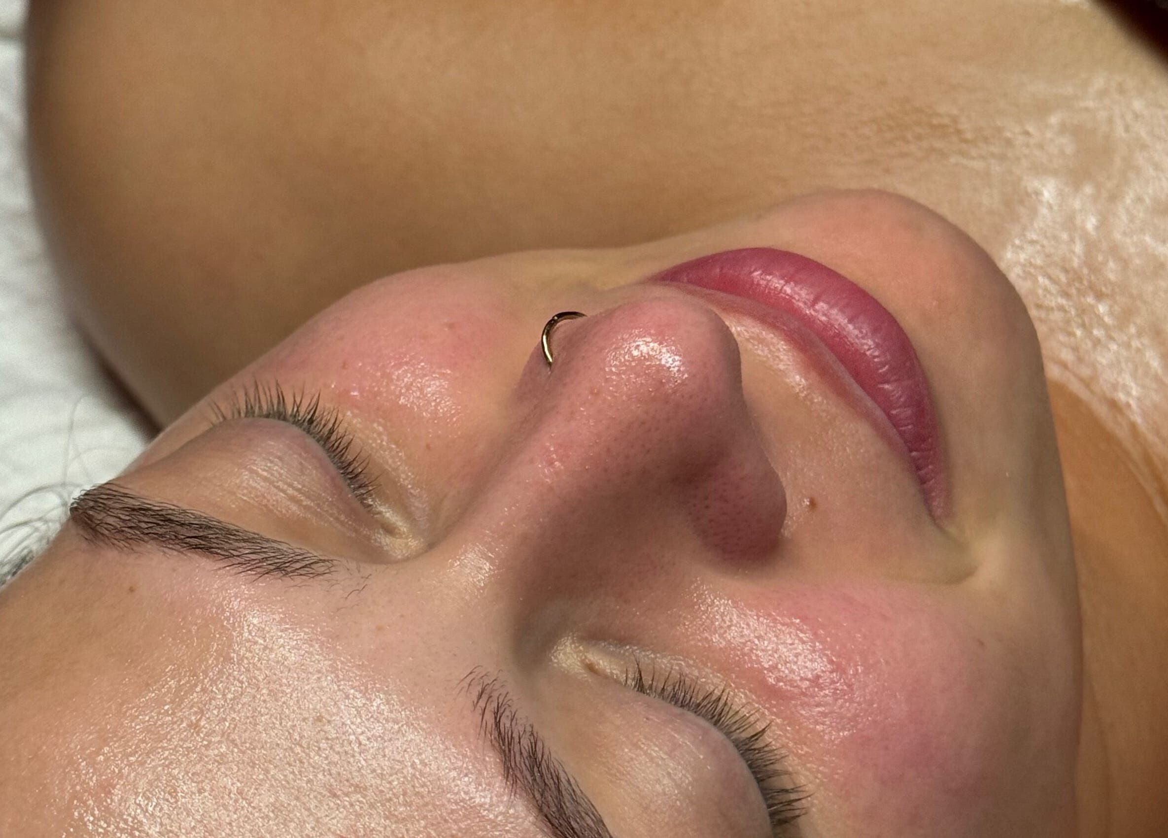 Close-up of a serene face with glowing skin at Aleestheticss, Laval, Québec, CA.