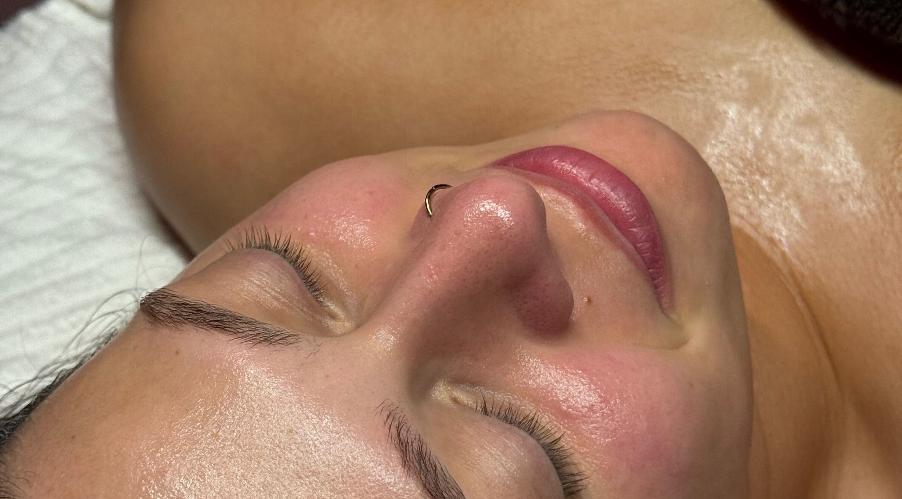 Close-up of a serene face with glowing skin at Aleestheticss, Laval, Québec, CA.