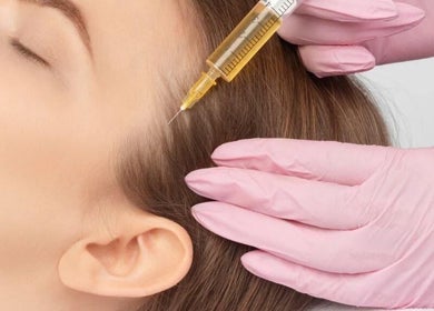 Hair treatment at 7even Trichology Clinic in London, England, GB, featuring a careful scalp injection procedure.