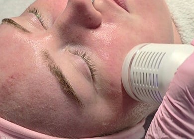 Facial treatment at Meraki Beaute MBS, enhancing skin's radiance in Stoke-on-Trent, England, GB.