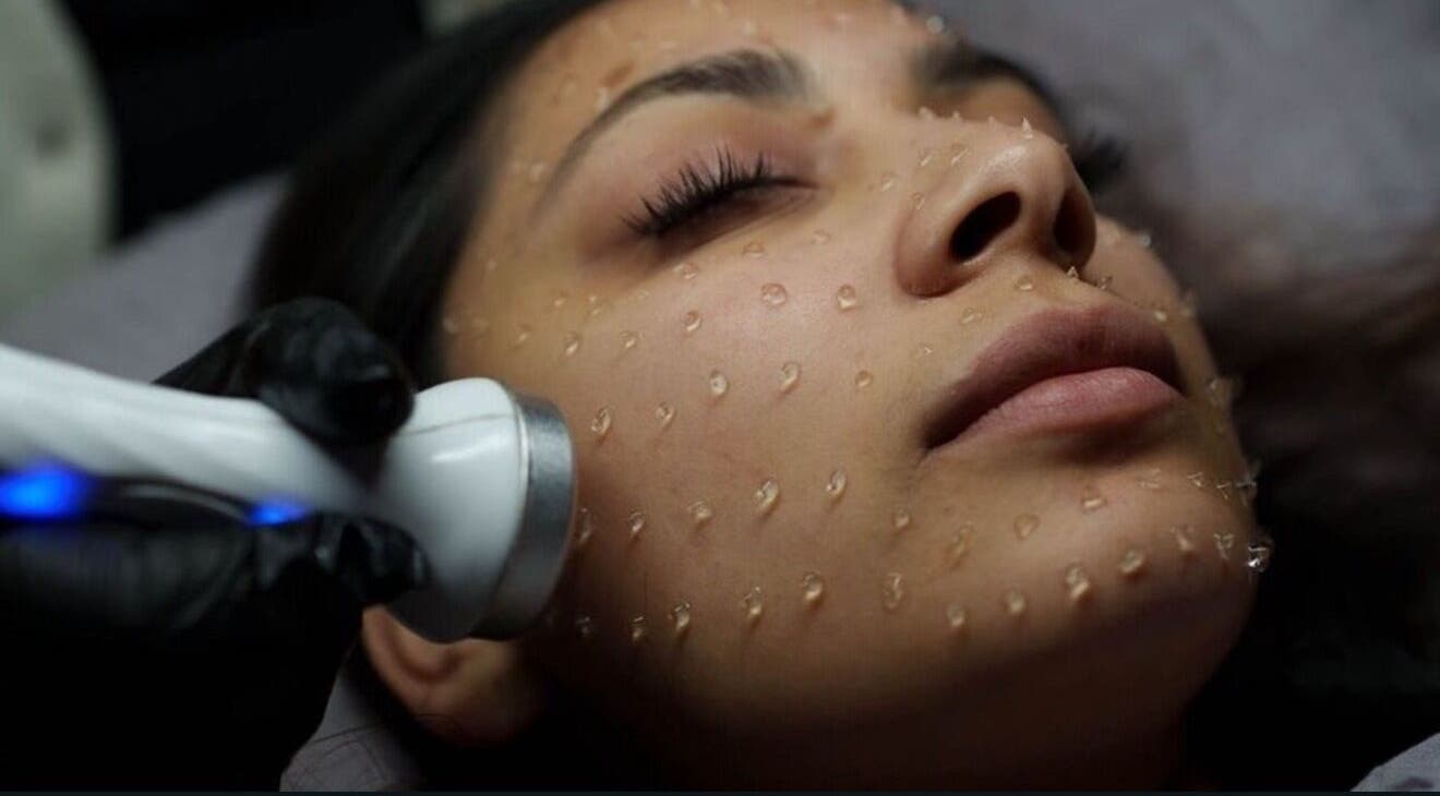 Facial treatment at SKR Beauty Skin Clinic in Middlesbrough, England. Discover rejuvenating skincare services.