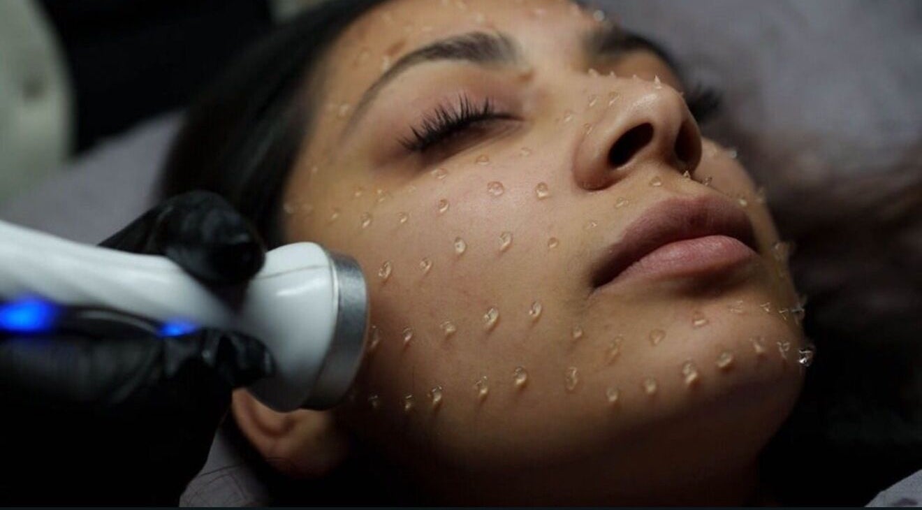 Facial treatment at SKR Beauty Skin Clinic in Middlesbrough, England. Discover rejuvenating skincare services.
