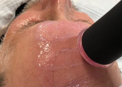 Intensive Behandlung bei CARRIE'S COSMETIC - Your Life’s Beauty - Dulsberg / Eilbek in Hamburg, Hamburg, DE.