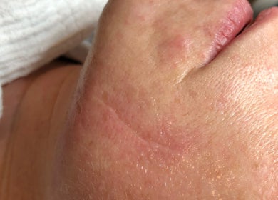 Nahaufnahme Hautpflege bei CARRIE’S COSMETIC | Kosmetikstudio Hamburg & Permanent Make-up Eppendorf, Hamburg, DE.