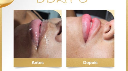 DL Estetica Avançada – obraz 2