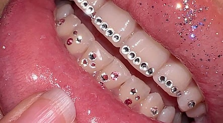 Sparkling tooth gems at Ever and Ivory - Teeth Whitening and Tooth Gems, Pimpama, Queensland, AU.